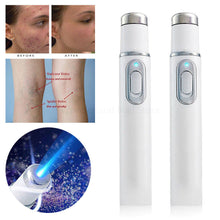 Load image into Gallery viewer, Wrinkle Removal Laser Treatment Pen